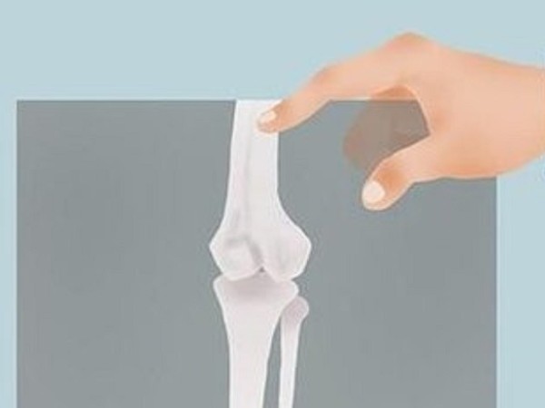 維生素D缺乏正悄悄盯上年輕女性