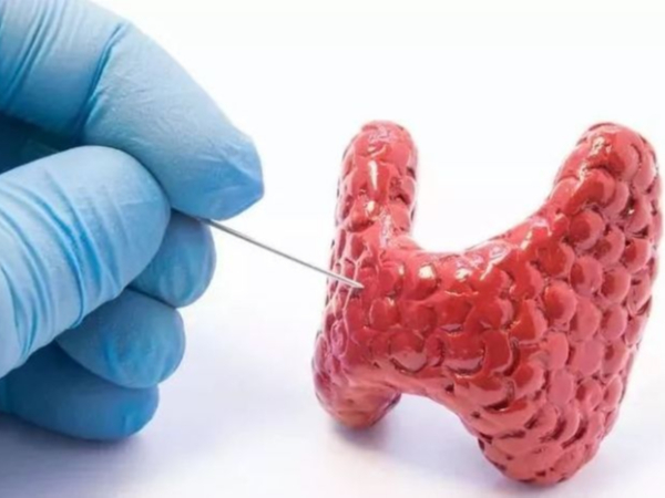 甲狀腺是怎么回事？健康生活這樣做