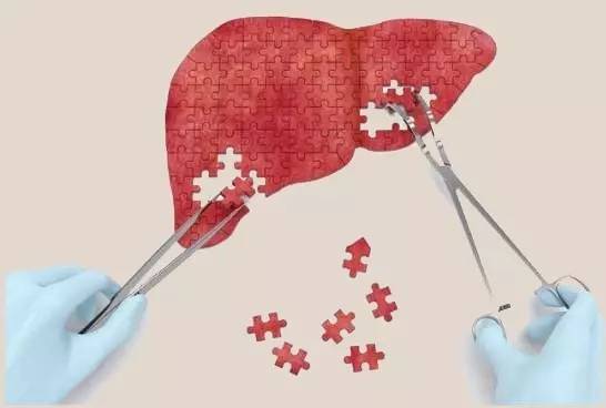 拯救不良肝臟，補充硒元素，真正預防肝病風險